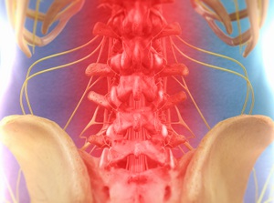 Spinal decompression for pain relief