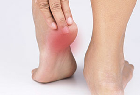 Plantar fasciitis pain testimonials